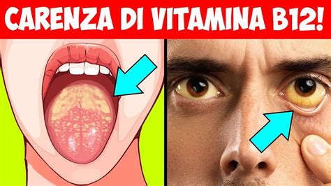 I 10 Segnali di avvertimento che nel tuo corpo c è carenza di vitamina