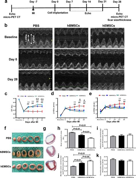 Changes In Cardiac Function After MI And HEMSC Implantation A