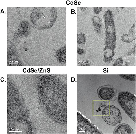 Biological Transmission Electron Micrographs For S Oneidensis After