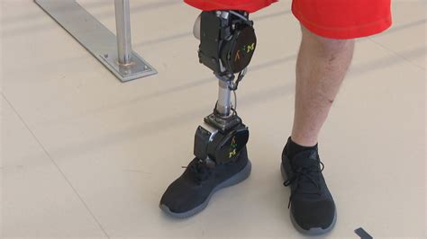 Chicago Lab Creates Cutting-Edge Bionic Prosthetics | Chicago News | WTTW