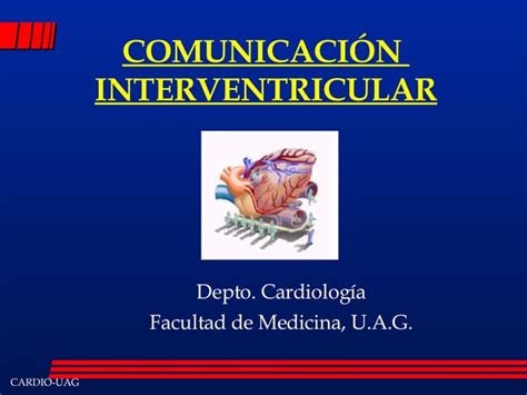 Comunicación Interventricular Ppt