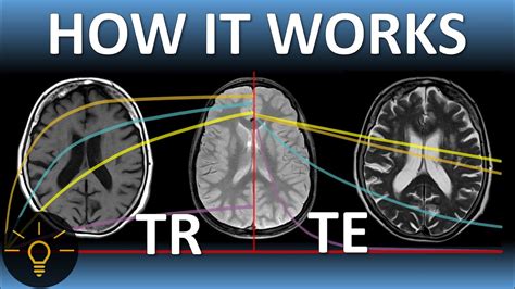 TR TE MRI Image Weighting T1 T2 PD EXPLAINED MRI Physics