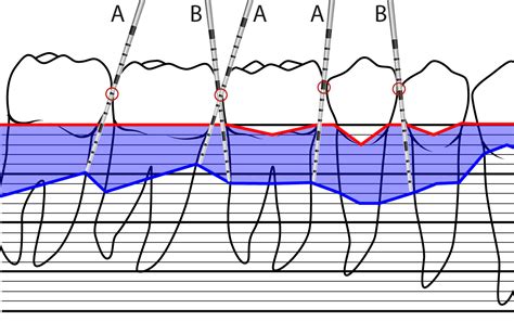 Periodontal Chart online - www.perio-tools.com