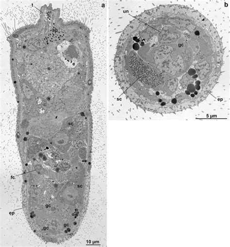 Miracidium Of Echinostoma Caproni Transmission Electron Micrographs Of