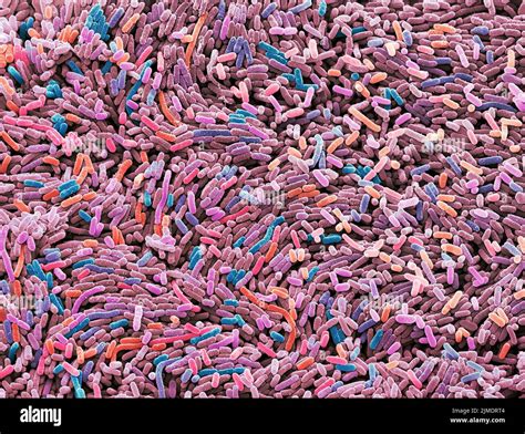 Microscope Image Of Bacteria Hi Res Stock Photography And Images Alamy