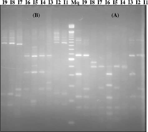 Pcr Rflp Profiles Of S Rrna Genes Of Isolates I I Digested