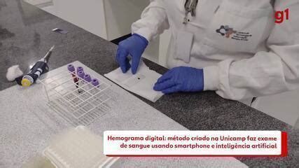 M Todo Criado Na Unicamp Faz Exame De Sangue Em Segundos Usando