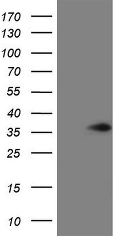 Vapb Monoclonal Antibody Oti C Truemab Origene L