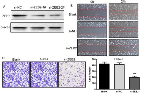 MicroRNA 200c Inhibits The Metastasis Of Triple Negative Breast Cancer