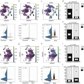 Identification Of Portal Mesenchymal Cells In Human Fetal Liver