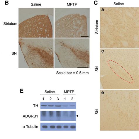 ADGRB1 Expression Downregulated In A MPTP Mouse Model A ADGRB1 Gene