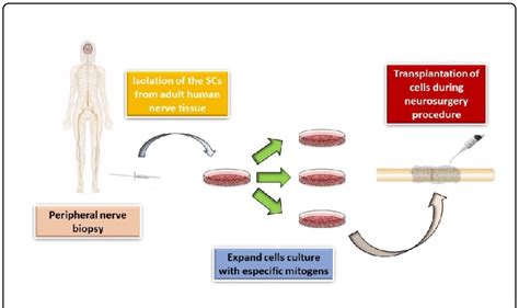 Schematic Representation Of Autologous Schwann Cells Transplantation In