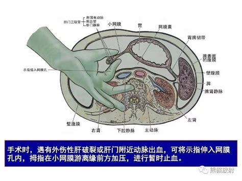 【解剖】腹膜及腹膜腔（經典講解匯總） 壹讀