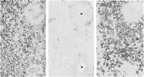 Immunocytochemistry Of The Periarterial Region Of Splenic White Pulp