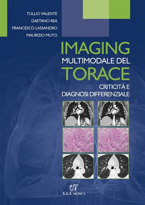 Imaging multimodale del torace Criticità e diagnosi differenziale