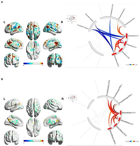 A Fga Related Dmn Connectivity At Baseline For Connectome Ring Download Scientific Diagram