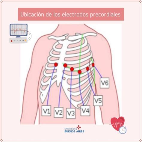 Pin On Cardiac Conduction System Electrical Conduction