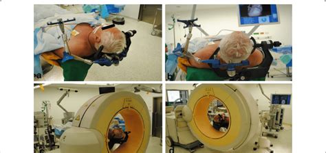 A B Patient Positioning In A Supine Position Head Fixation In A