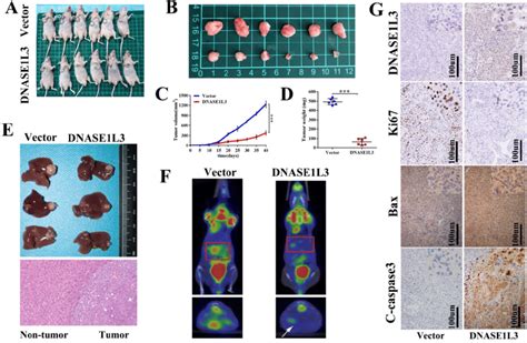 DNASE1L3 Overexpression Inhibited HCC Tumor Growth And Induced