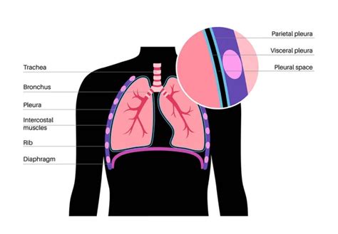 Pleura Anatomy Concept Chest Cavity Medical Poster Membrane Tissue