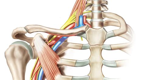 Brachial Plexus Treatment Archives Samarpan Physiotherapy Clinic