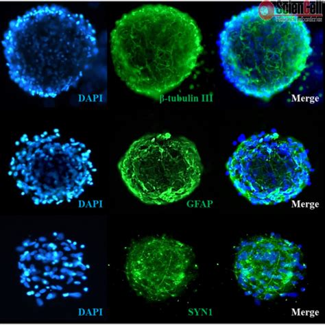 Sciencell Ready To Use 3D Spheroids Kits Team Medical Scientific