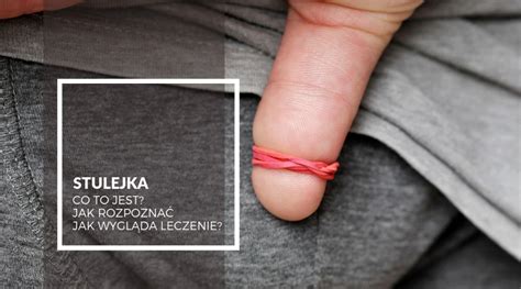 Stulejka co to jest jak rozpoznać i jak wygląda leczenie