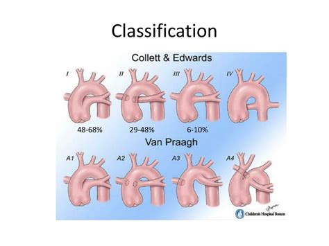 Ppt Truncus Arteriosus Powerpoint Presentation Free Download Id 6569500