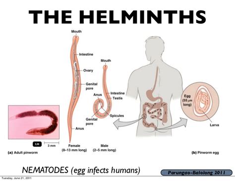 Trick to remember diseases caused by Helminths | GK-Tricks.com