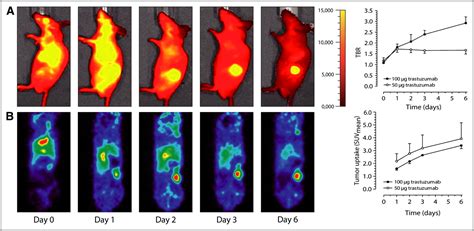 Intraoperative Near Infrared Fluorescence Tumor Imaging With Vascular