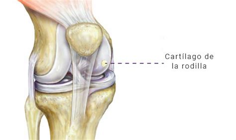 ᐅ Lesión Cartílago Rodilla Málaga Dr Abel Gómez