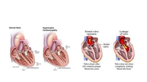 pulse arterial pulse types pptx heart  cardiovascular