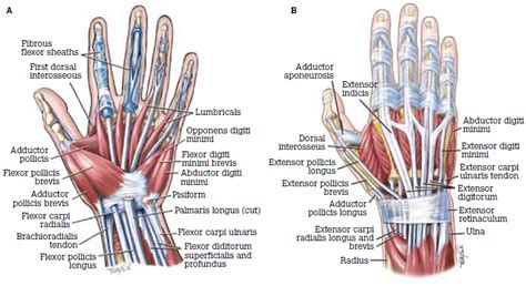 Figure 1. Anatomy of the hand A) Volar aspect; B) Dorsal aspect | Hand anatomy, Hand bone ...