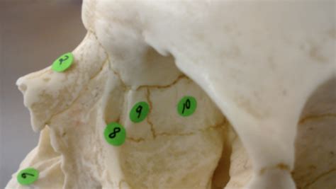 Bio 201 Lab 6 Axial Skeleton Flashcards Quizlet