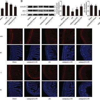 Catalpol Inhibited Oxidative Stress And Inflammation In Rat Intestinal