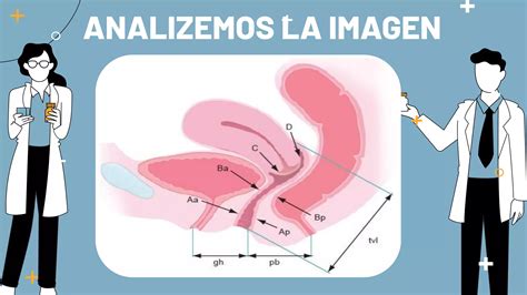 Anatom A Patol Gica De Los Prolapsos Genitourinarios Tipos De Prolapso Pdf