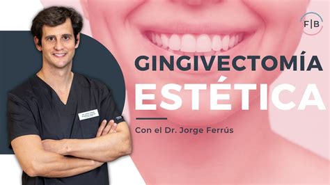 GINGIVECTOMÍA mejora la estética de tus ENCÍAS y soluciona la SONRISA