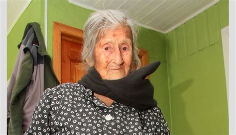 Mujer De 92 Años Lleva En Su Vientre Un Feto Momificado Desde Hace Cinco Décadas Cnn