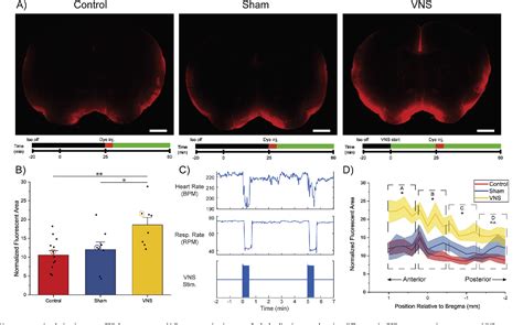 Figure 1 From Clinically Derived Vagus Nerve Stimulation Enhances