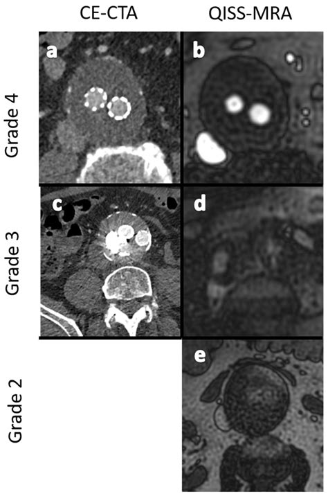 Jcm Free Full Text Clinical Evaluation Of Non Contrast Enhanced Radial Quiescent Interval