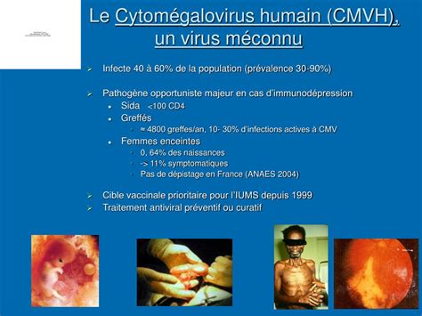 PPT Diagnostic et suivi de linfection à cytomégalovirus PowerPoint