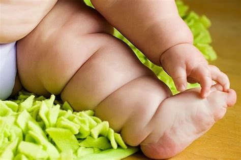 La Calabria Tra Le Prime Regioni In Europa Per Obesit Infantile