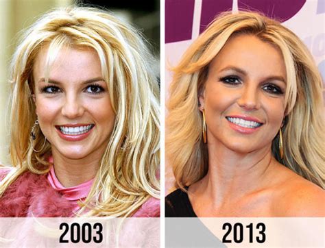 Britney Spears Plastic Surgery