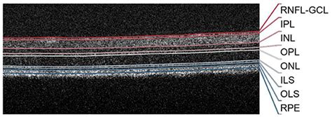 Frontiers Normative Mice Retinal Thickness 16 Month Longitudinal Characterization Of Wild