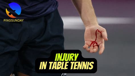 Case Study For The Injury Accident In Table Tennis YouTube