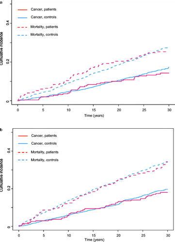 Full Article Incidence Of Cancer In Patients With Ulcerative Colitis