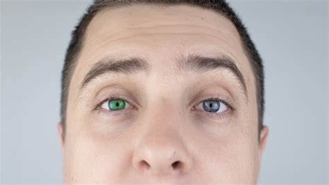 Heterocromia Por Que Algumas Pessoas Podem Ter Olhos De Cores