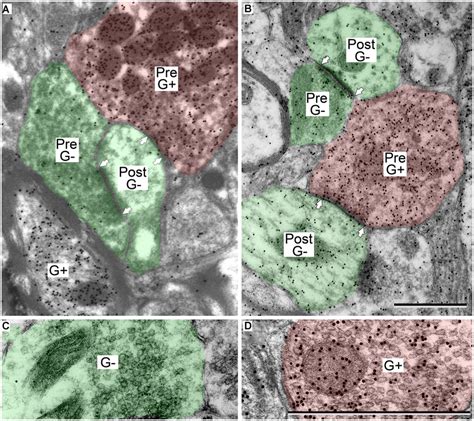 Electron Micrographs Showing Examples Of Gaba Positive And