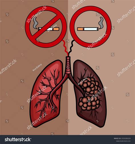 Healthy And Unhealthy Lungs Drawing