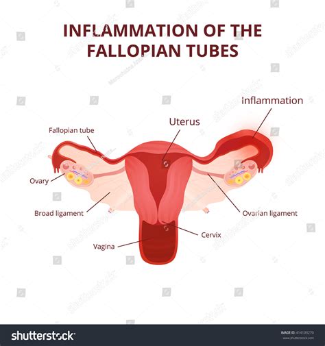 Female Reproductive System Uterus Ovaries Scheme Stock Vector (Royalty ...